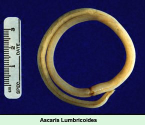 Click Here To See the NEXT image ( 3 ) ( Ascaris Lumbricoides - round worm - human intestinal parasites ) 