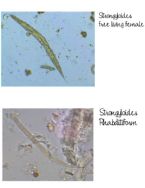 1c STRONGYLOIDES TYPES