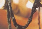 Mucoid Plaque. Photo from Dr. Jensen's  Bowel Management Book