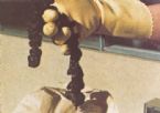 Mucoid Plaque. Photo from Dr. Jensen's  Bowel Management Book