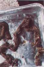 Mucoid Plaque. Photo from Dr. Jensen's  Bowel Management Book