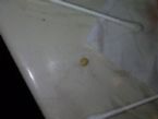 stone or parasite?