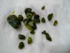 Big liver stone ... (Click to enlarge)