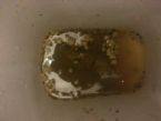 my 6 th liver shows the first results