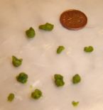 2nd liver flush with quarter cup olive oil and 1 lemon ... (Click to enlarge)