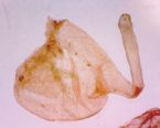 Afterliver flush ... (Click to enlarge)