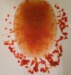 Coffee Enema results ... (Click to enlarge)