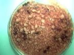 liver flush results- lots of ... (Click to enlarge)