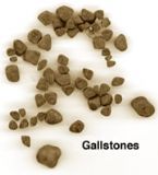 liver_gallbladder/gallbladder_removed
