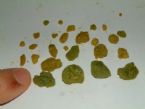 1st Liver Flush 27 5 2011 ... (Click to enlarge)