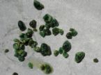 4th Liver Flush ... (Click to enlarge)