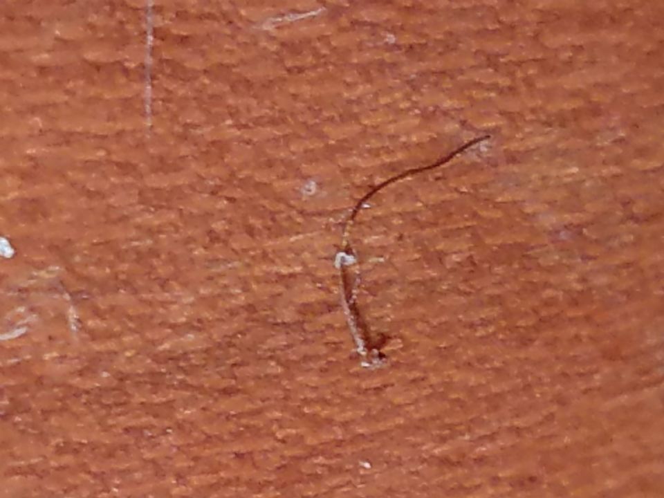Image: Hair from cheek Image: Hair from cheek