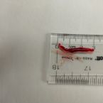 Blood Sucker from Sinus - Tapeworm? ... (Click to enlarge)