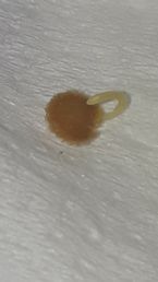 Parasite worm egg or sac ... (Click to enlarge)
