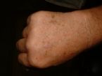 Hand 1 ... (Click to enlarge)