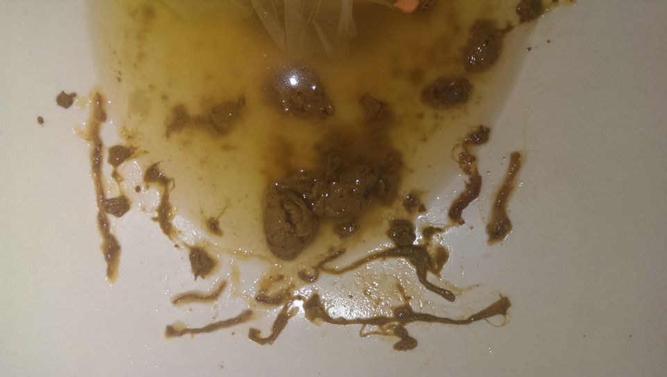 Image: Gross PARASITES!!! Image: Gross PARASITES!!!