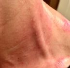 Early photo of jugular neck area ... (Click to enlarge)