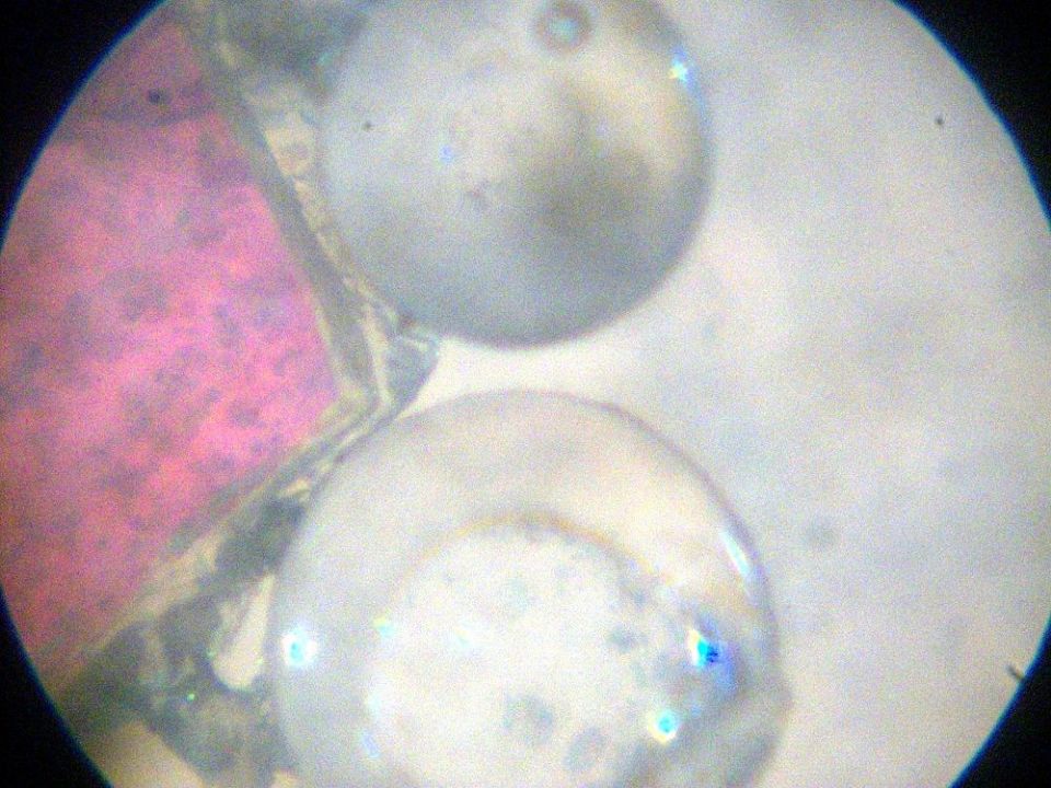 Image: 039 parasite eggs ...maybe? Image: 039 parasite eggs ...maybe?