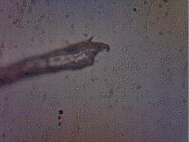 //www.curezone.org/upload/Parasites/092341.bmp