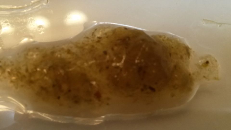 Image: Green Mucus from Intestines - fluke eggs Image: Green Mucus from Intestines - fluke eggs