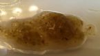 Green Mucus from Intestines - fluke eggs