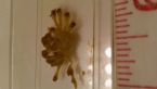 Candida Fungi or gamete from fish parasite reproductive cycle