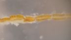 Nematophagous Fungi - Dactylaria candida Nematode-Trapping Fungus