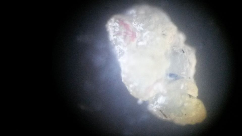 Image: Parasite under the skin-Hatching from Casing Image: Parasite under the skin-Hatching from Casing