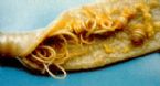 ascaris_lumbricoides