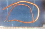 parasites/ascaris_lumbricoides
