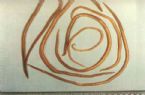 parasites/ascaris_lumbricoides