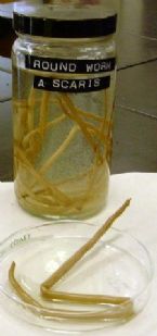 parasites/ascaris_lumbricoides