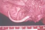 ascaris_lumbricoides