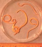 parasites/ascaris_lumbricoides