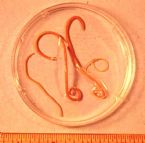 parasites/ascaris_lumbricoides