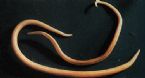 parasites/ascaris_lumbricoides