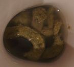 Candida or Parasite eggs ... (Click to enlarge)
