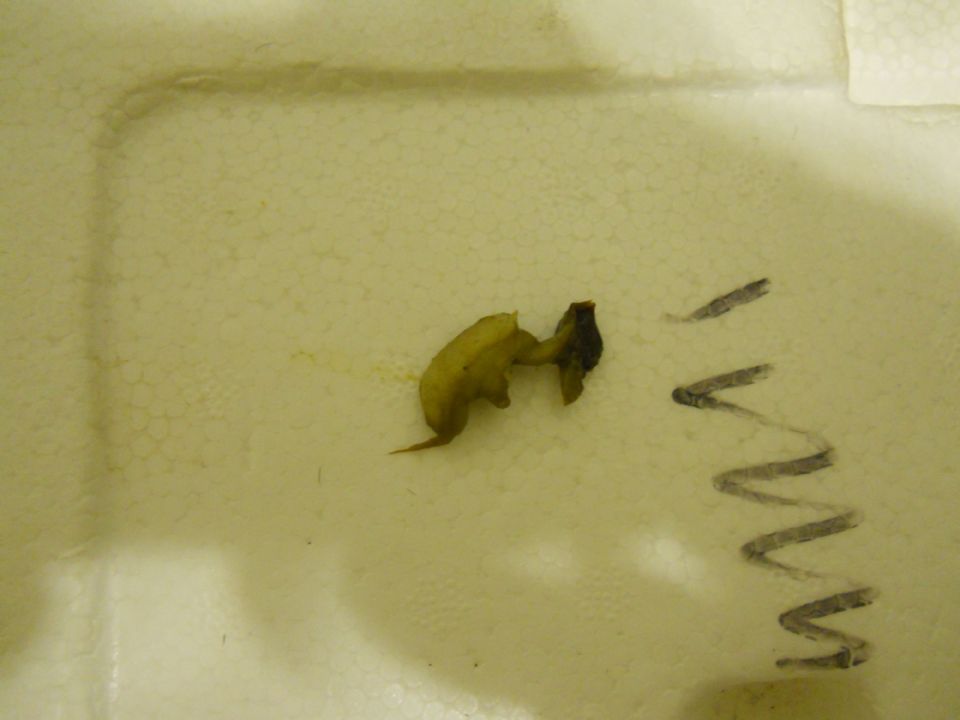 //www.curezone.org/upload/Parasites/DSCN0397.jpg