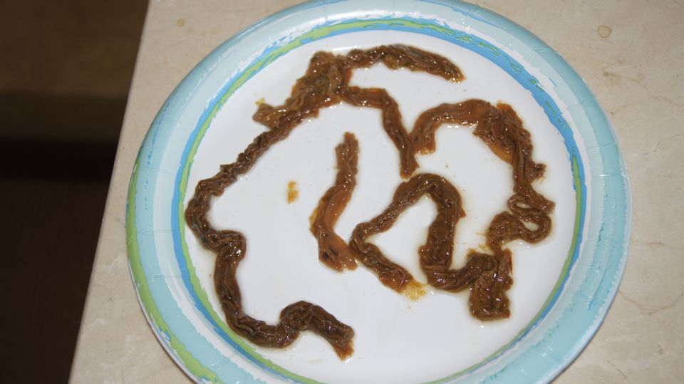//www.curezone.org/upload/Parasites/Forum_01/DSC01349.jpg