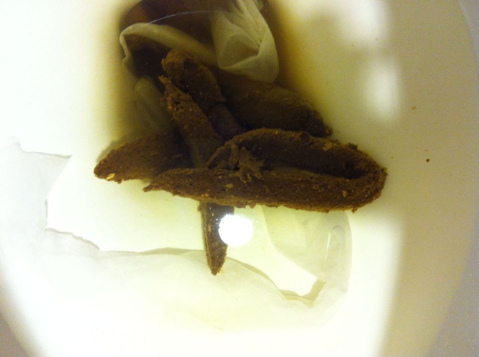 //www.curezone.org/upload/Parasites/Forum_01/IMG_2589_1_.jpg