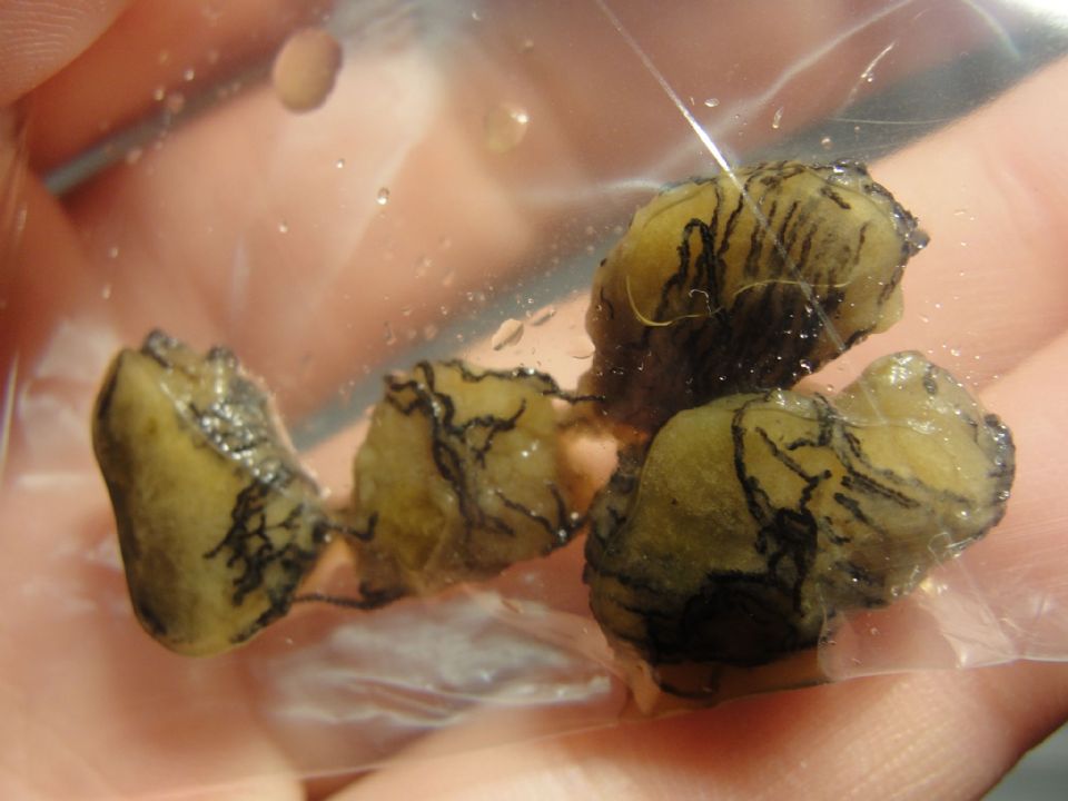 tiny balls of mucus in stool tiny balls of mucus in stool
