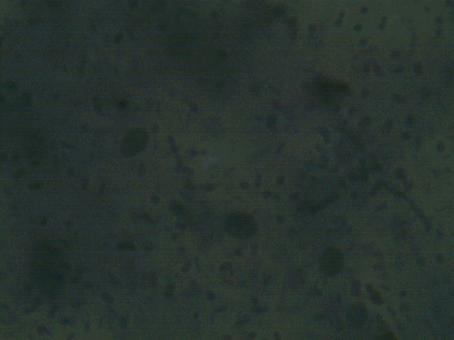 //www.curezone.org/upload/Parasites/Forum_01/TS_06_21_19_34_06.png