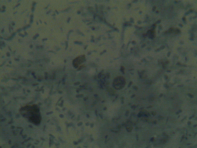 //www.curezone.org/upload/Parasites/Forum_01/TS_06_21_19_34_30.png