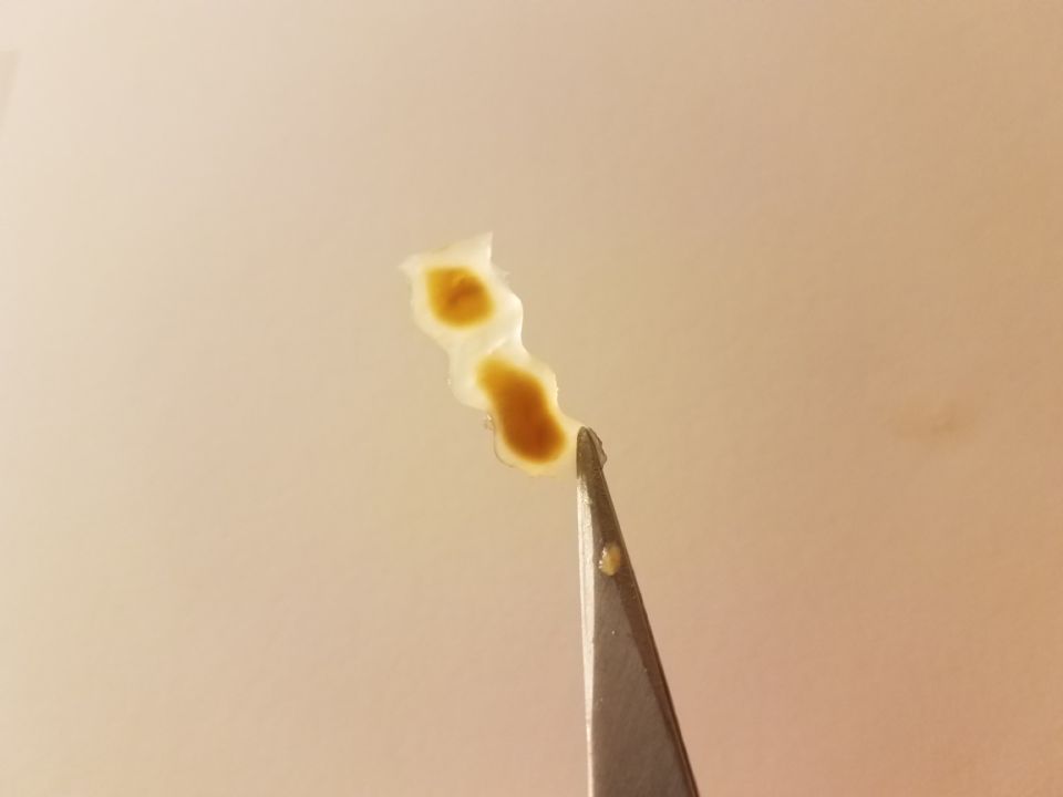 Image: Tapeworm fragment 4 Image: Tapeworm fragment 4