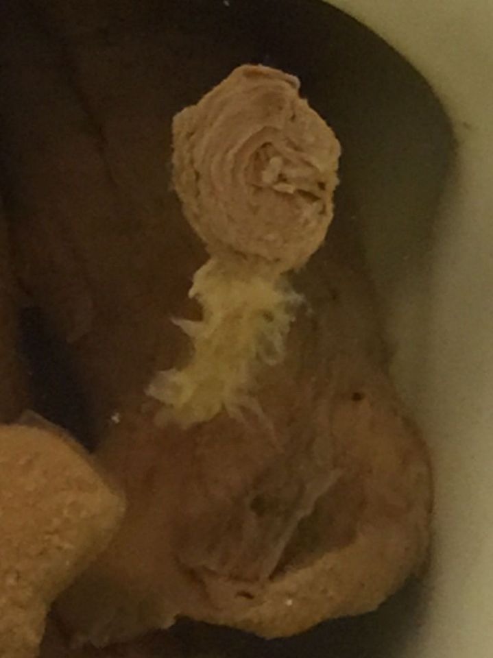 Image: Rose/ribbon looking poop with mucous/candida/parasite? hanging off Image: Rose/ribbon looking poop with mucous/candida/parasite? hanging off