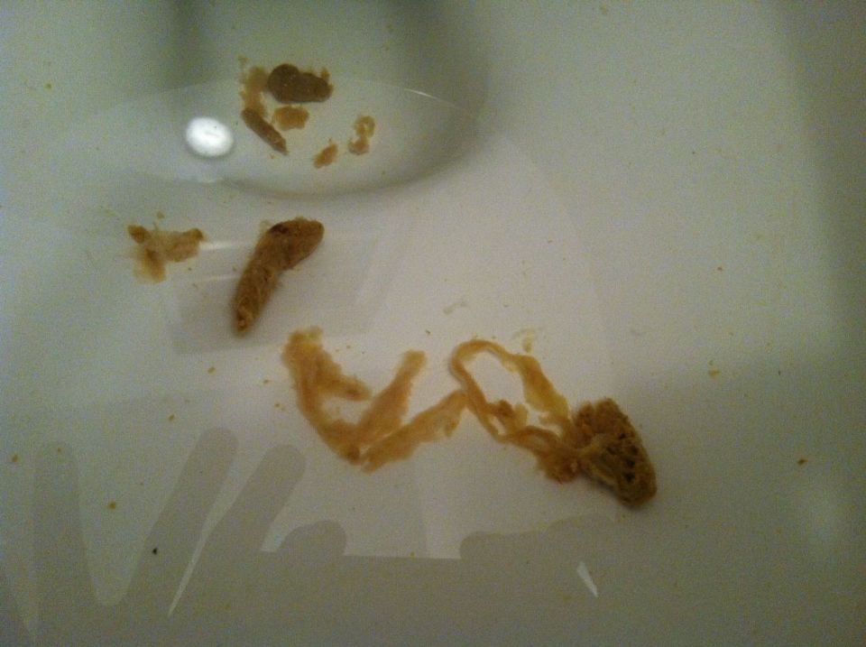 flat white worms in dog poop flat white worms in dog poop