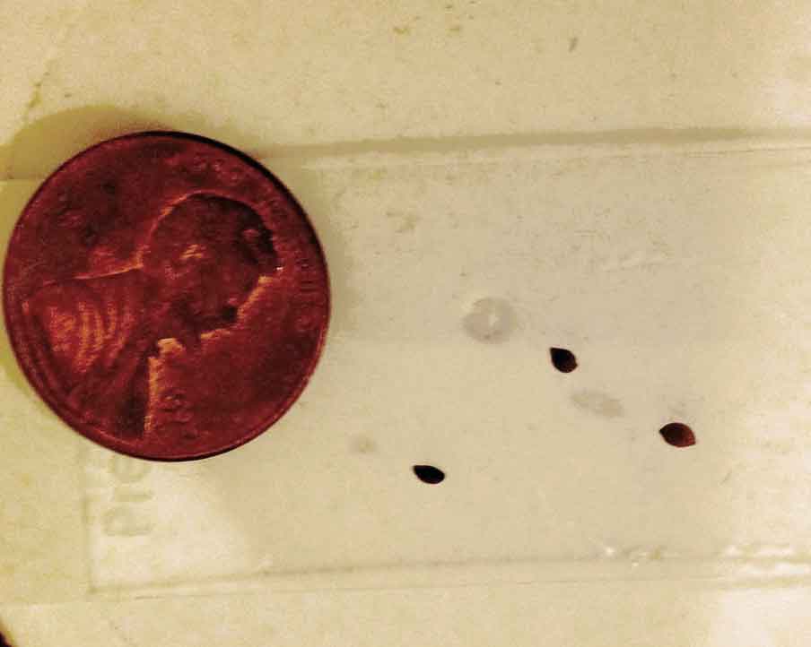 What are these &ldquo;seeds&rdquo; in my sons stool? He doesn&rsquo;t eat anything that