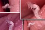 Please help ID invisible skin parasite! ... (Click to enlarge)