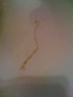 Mucus or Parasite? ... (Click to enlarge)