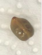 Parasite 5 ... (Click to enlarge)